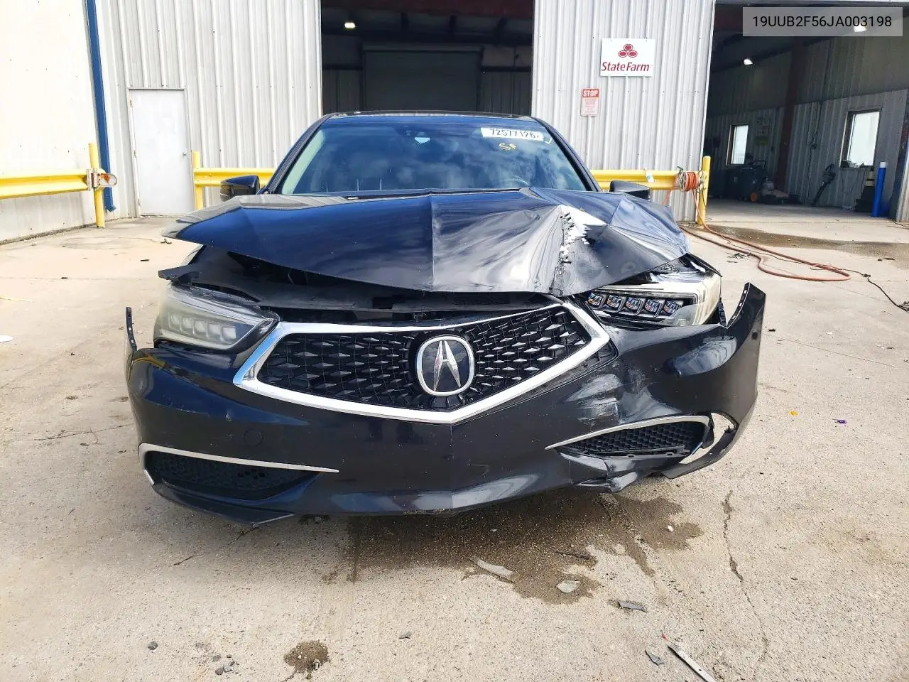 2018 ACURA TLX VIN 19UUB2F56JA003198 — фото 5