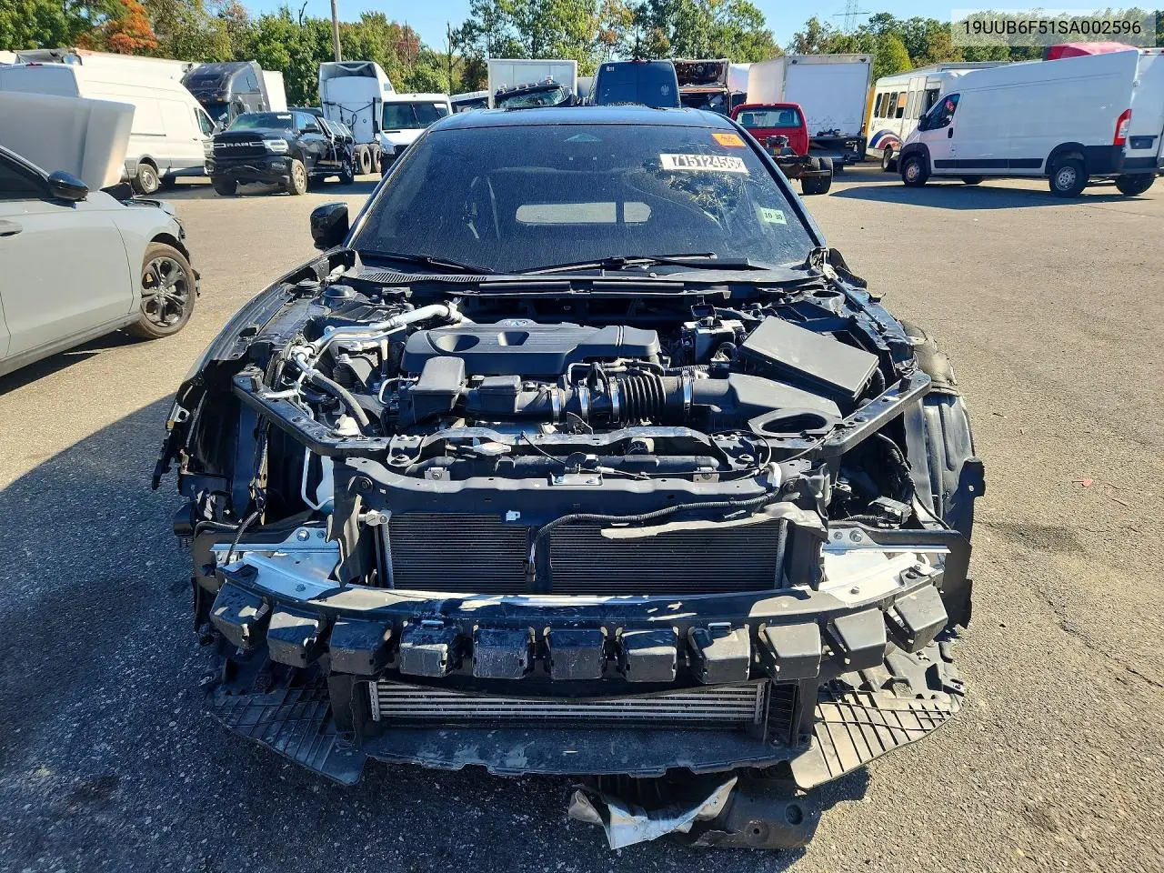2025 ACURA TLX VIN 19UUB6F51SA002596 — фото 5