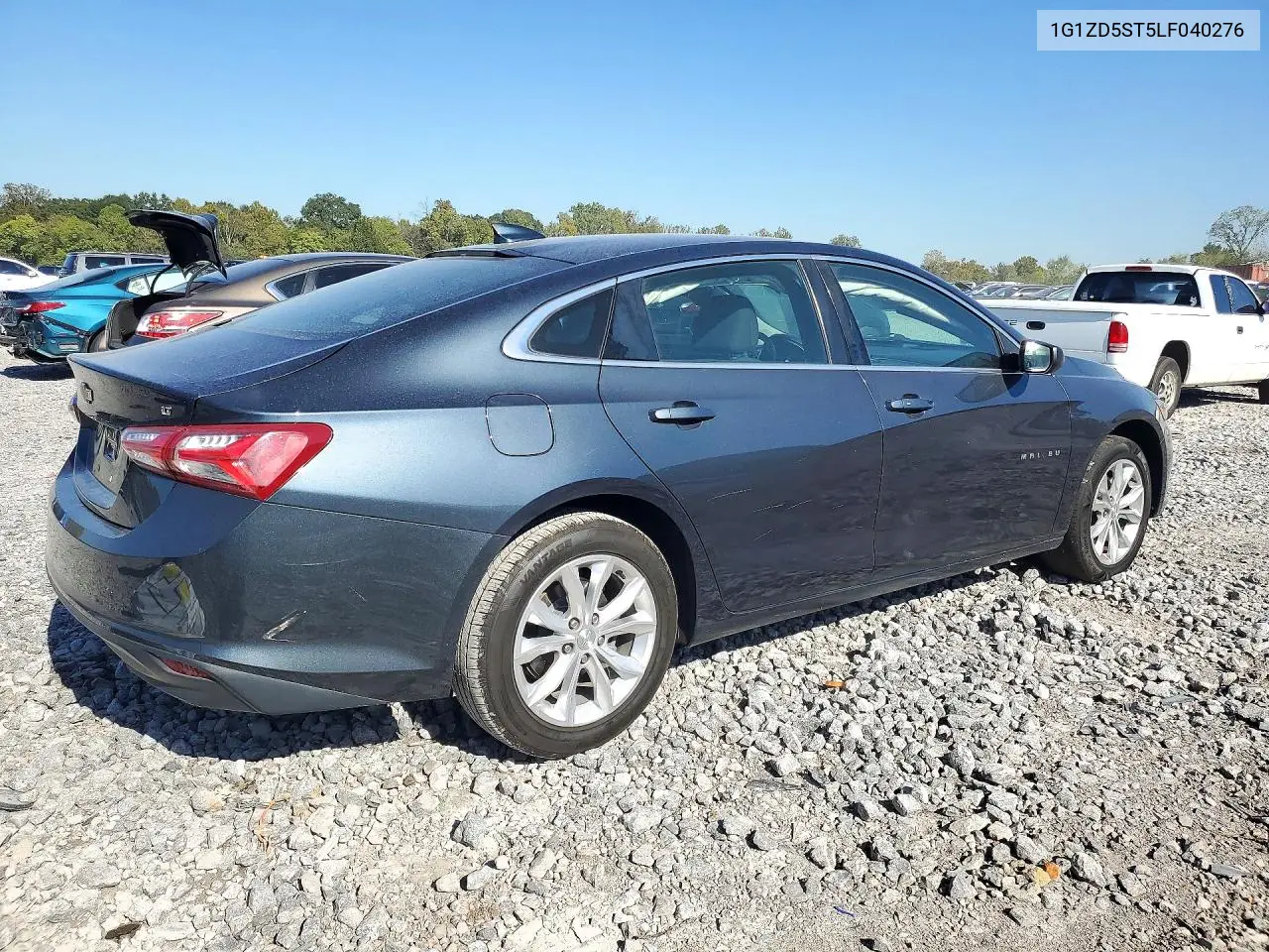 2020 CHEVROLET MALIBU VIN 1G1ZD5ST5LF040276 — фото 3