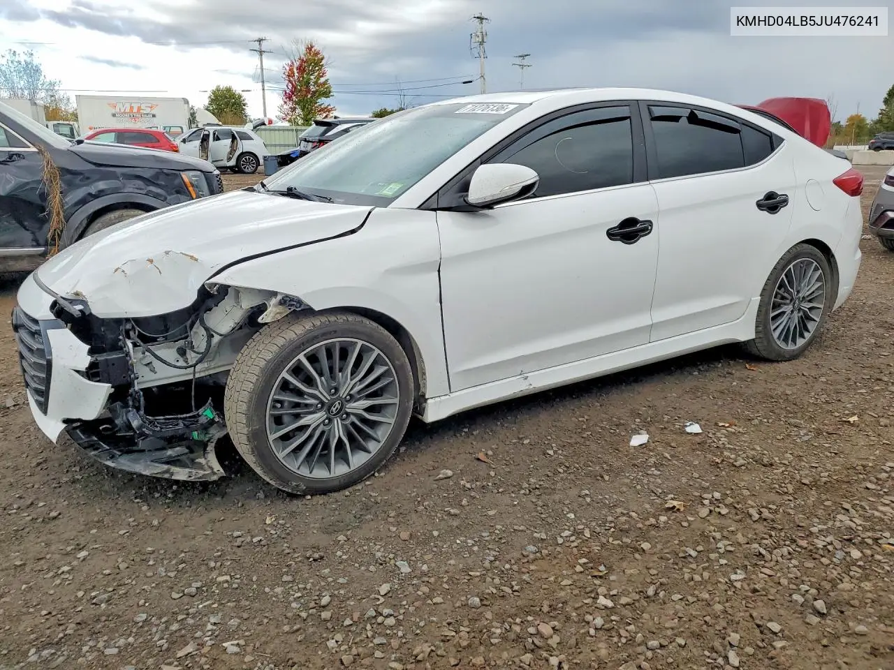 HYUNDAI ELANTRA 2018, VIN KMHD04LB5JU476241