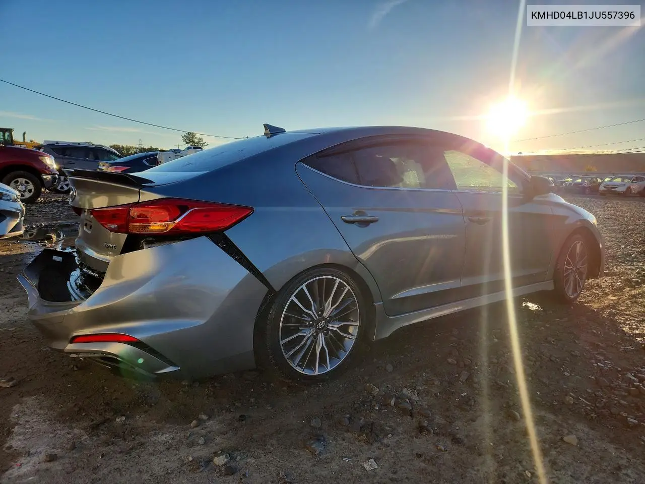 2018 HYUNDAI ELANTRA VIN KMHD04LB1JU557396 — фото 3