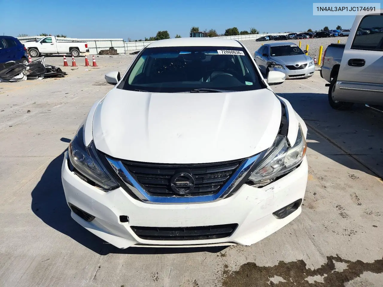 2018 NISSAN ALTIMA VIN 1N4AL3AP1JC174691 — фото 5