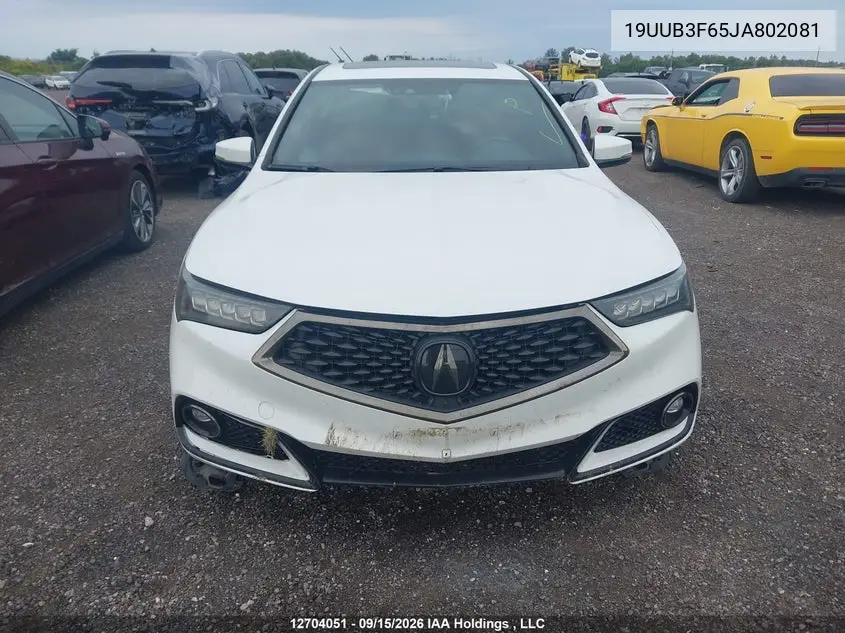 2018 ACURA TLX VIN 19UUB3F65JA802081 — фото 12