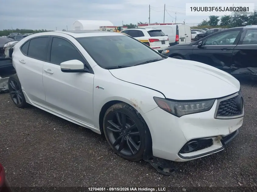 2018 ACURA TLX VIN 19UUB3F65JA802081 — фото 13