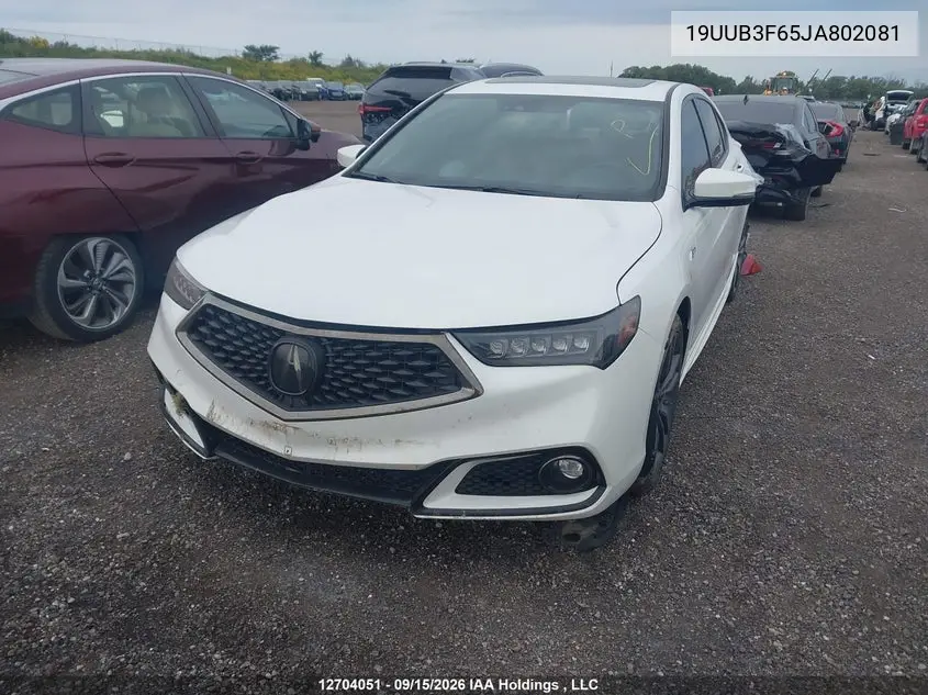 2018 ACURA TLX VIN 19UUB3F65JA802081 — фото 2