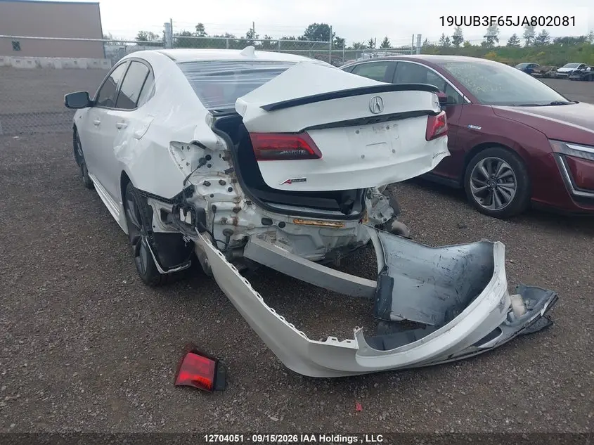 2018 ACURA TLX VIN 19UUB3F65JA802081 — фото 3