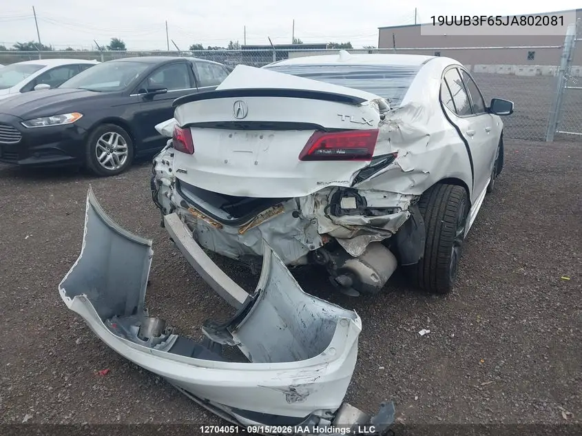 2018 ACURA TLX VIN 19UUB3F65JA802081 — фото 4