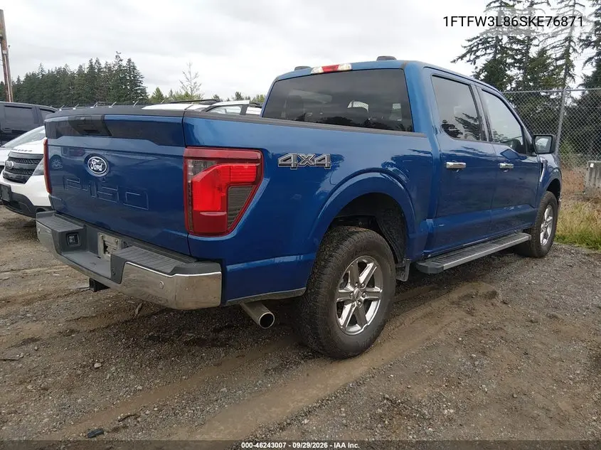 2025 FORD F-150 VIN 1FTFW3L86SKE76871 — фото 4